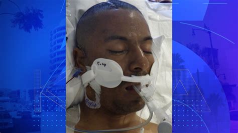Los Angeles General looking to identify patient found on 101 Freeway